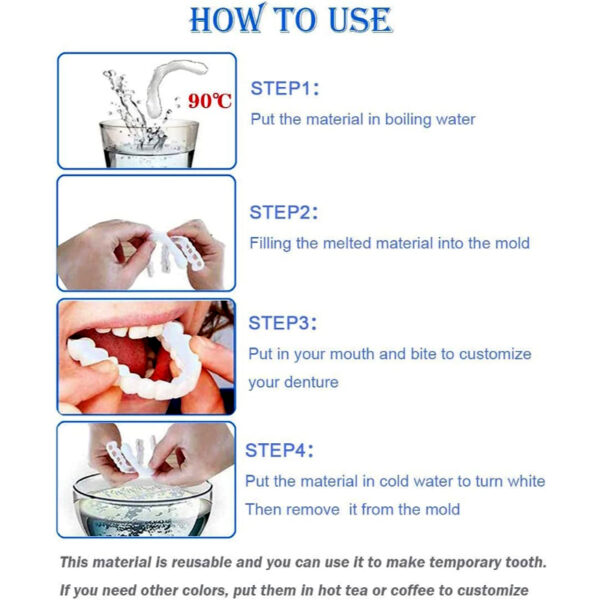 Custom Fit Perfect Smile Veneers - Image 4