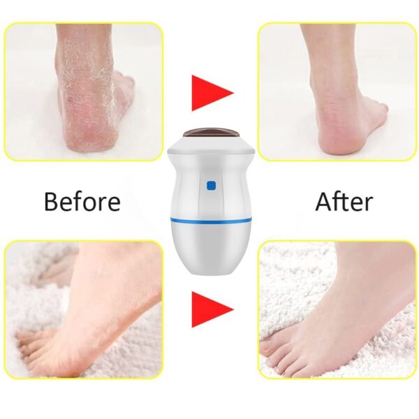 Foot Care Tool Electric Grinder Machine Foot Dead Skin Exfoliator best results